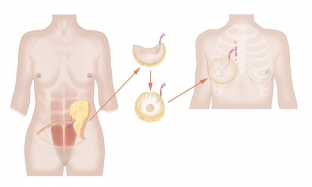 otkuda-vzyat-kozhnyj-transplantat-osnovnye-donorskie-zony