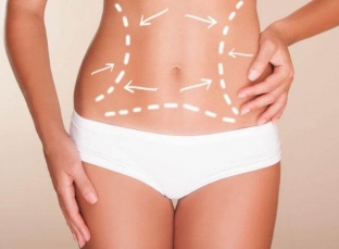 poluchit-krasivyj-zhivot-bez-usilij-pomozhet-operatsiya-abdominoplast
                        ></p>
<blockquote>
<p>Перевагою абдомінопластики в клініці Medical Club є можливість поєднувати цю операцію з ліпосакцією та деякими іншими процедурами для досягнення найкращого результату.</p>
</blockquote>
<p>Абдомінопластика – це складна, але дуже ефективна операція, яка допомагає забути про обвислий і негарний живот назавжди. Читайте на estet-portal.com більше статей про корекцію тіла у розділі «Пластична хірургія».</p>


                        


                                            </div>
                                        <div id=