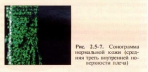 povrezhdeniya-tkanej-pod-vozdejstviem-sveta-i-instrumentalna-diagnostika-sostoyan kozhnykh-pokrovov