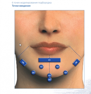protsedura-korrektsii-podborodka-dlya-garmonichnogo-i-privlekatelno-litsa