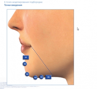 protsedura-korrektsii-podborodka-dlya-garmonichnogo-i-privlekatelno-litsa