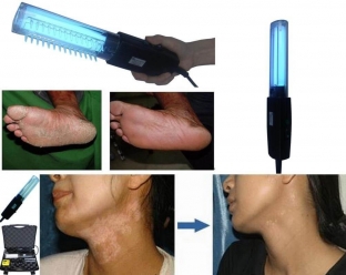 puva-terapiya-sovremennye-tekhnologii-protiv-psoriaza-i-vitiligo