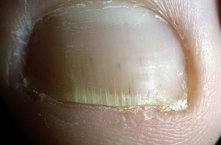 raznovidnosti-i-osnovnye-prichiny-onikhodistrofij