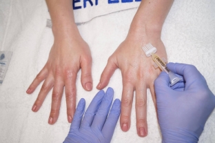 sochetannaya-metodika-korrektsii-vozrastnykh-izmenenij-ruk