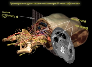 sovremennye-metody-diagnostiki-raka-pochki-kak-obnaruzhit-opukhol