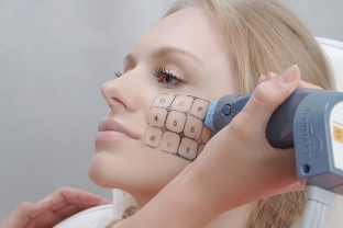 termolifting-litsa-i-tela-omolozhenie-s-pomoshchyu-tepla