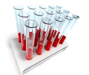 uchenye-otkryli-mekhanizm-formirovaniya-trombotsitov