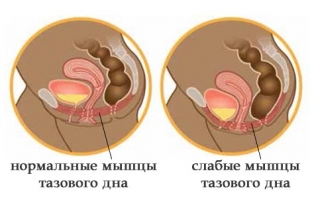 vumbilding-kratchajshij-put-k-intimnomu-zdorovyu-i-potryasayushmu seksu